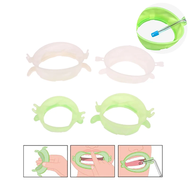 Teeth Whitening Accelerator - 3 Buah S/M/L Alat Ortodontik Penyebar