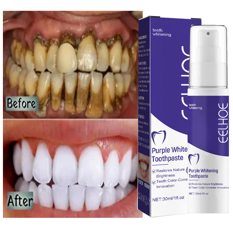 Teeth Whitening Korea - 1 buah pasta gigi pemutih pembersih