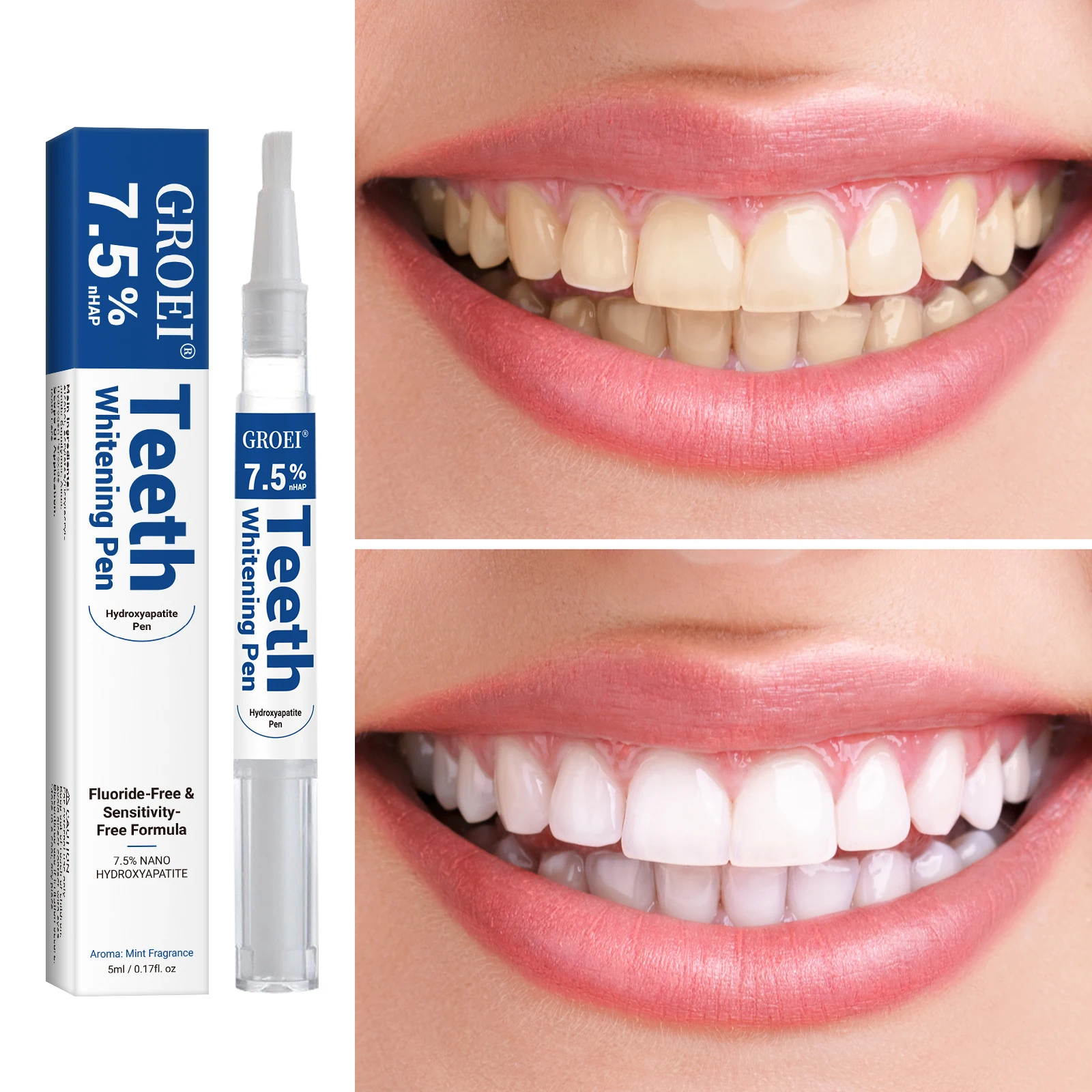 Pena Pemutih Gigi Hidroksiapat - Teeth Whitening Gel Peroxide ulasan dan harga