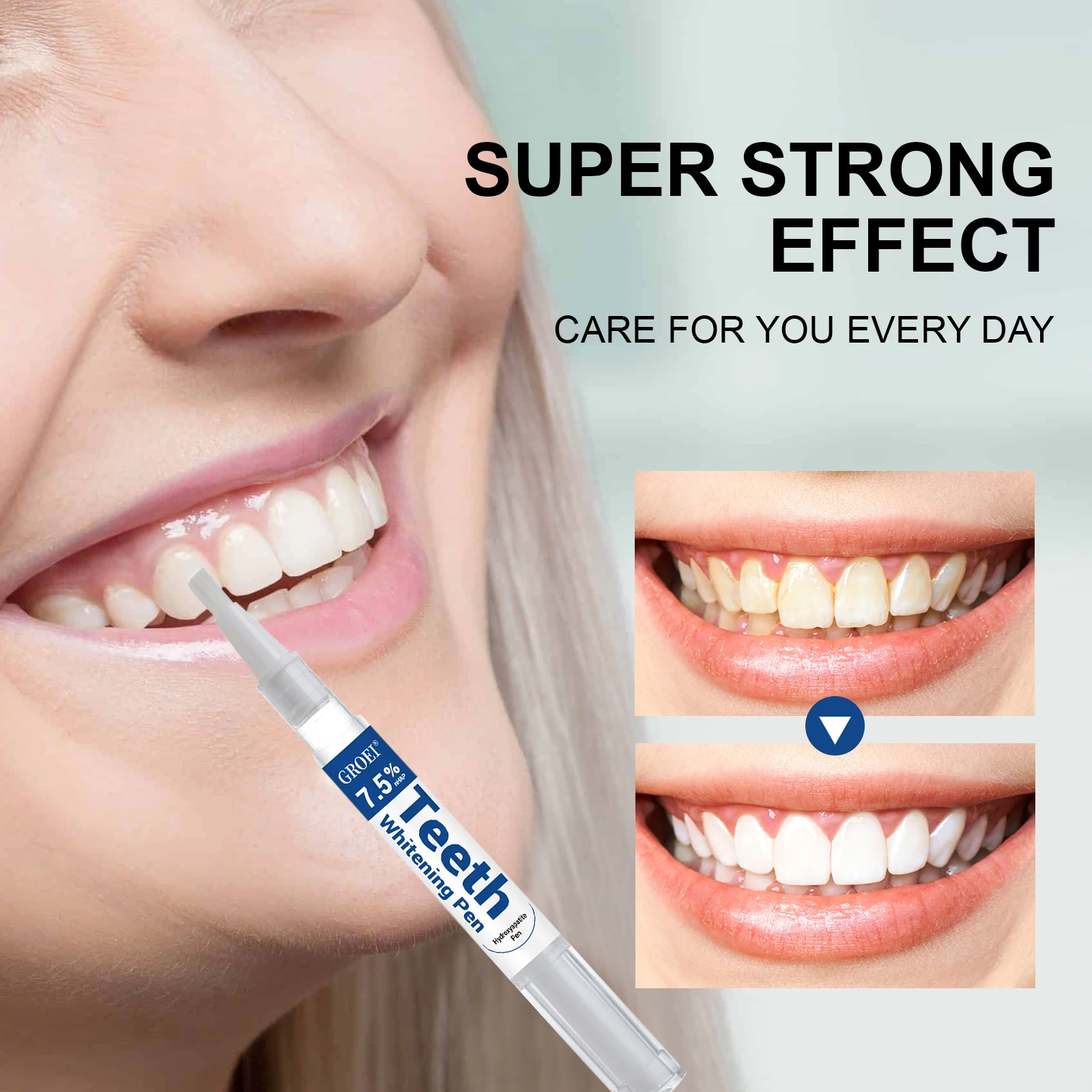 Pena Pemutih Gigi Hidroksiapat - Teeth Whitening Gel Peroxide ulasan dan harga