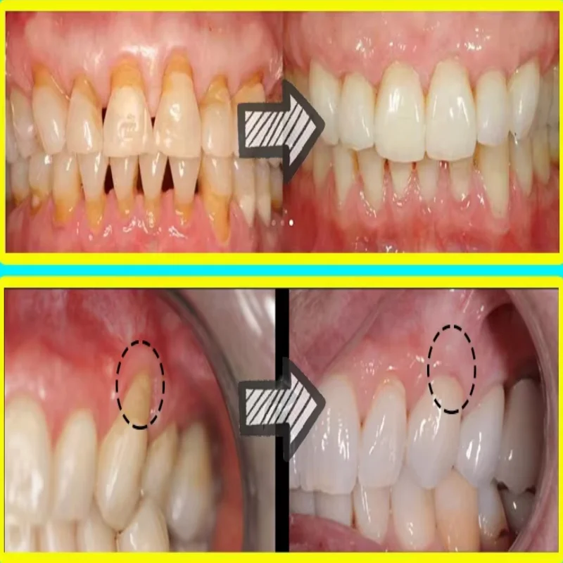 Serum Perbaikan Cepat Pereda P - Teeth Whitening Baking Soda ulasan dan harga