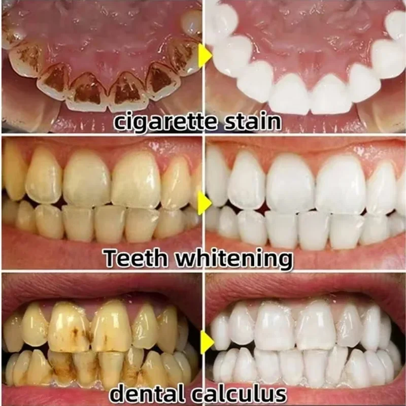 Serum Perbaikan Cepat Pereda P - Teeth Whitening Baking Soda ulasan dan harga