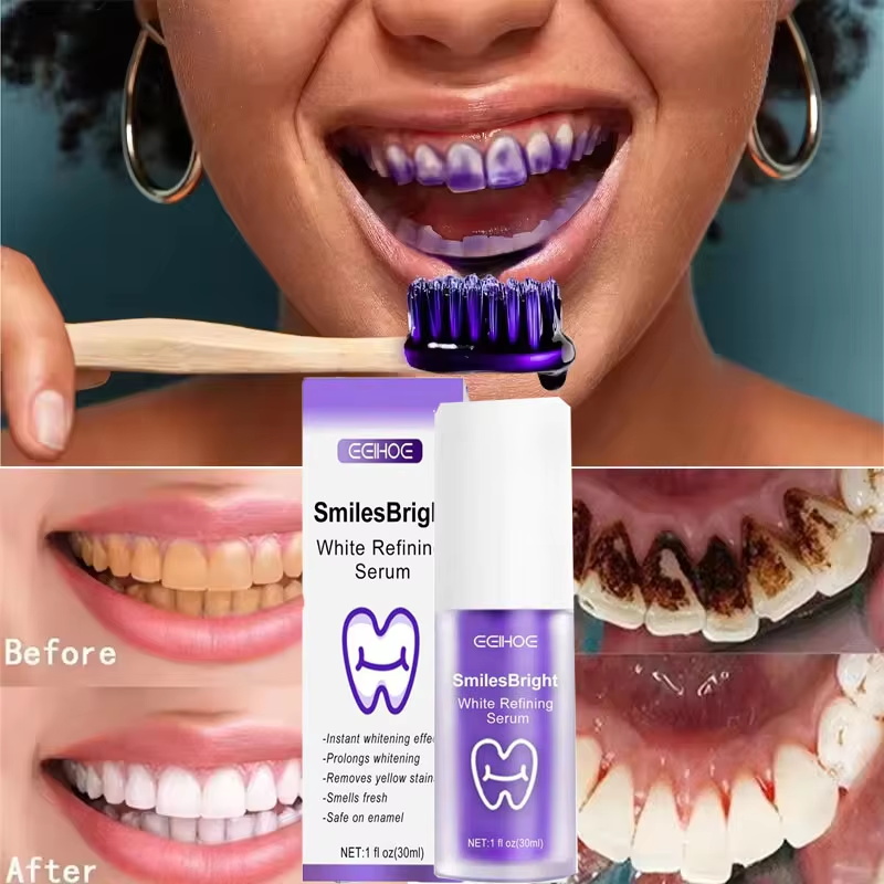 Pasta Gigi Pemutih Pembersih G - Teeth Whitening Korea ulasan dan harga