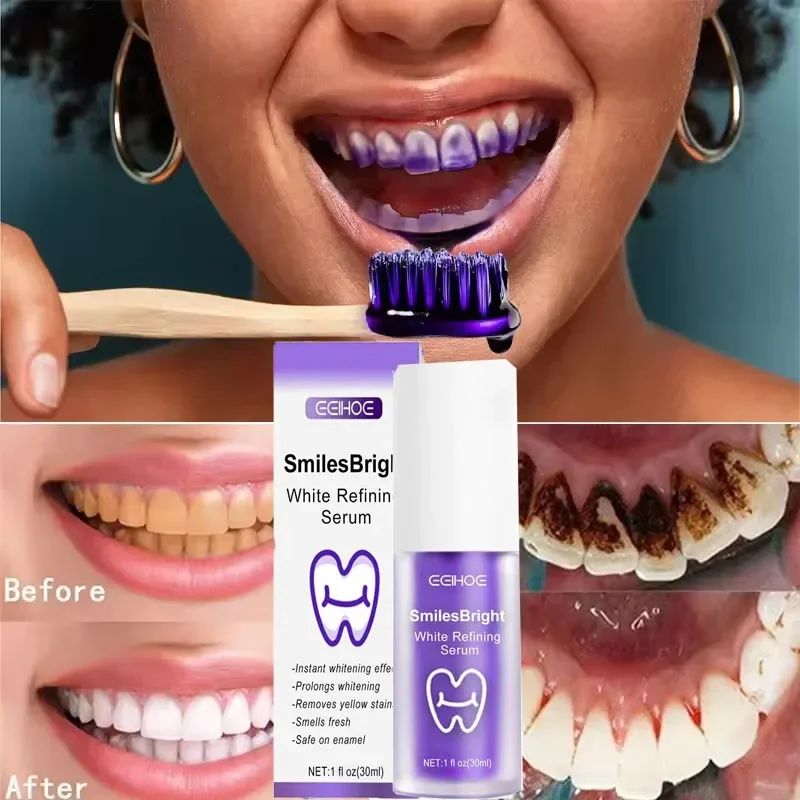 Pasta Gigi Pemutih Pembersih G - Teeth Whitening Korea ulasan dan harga