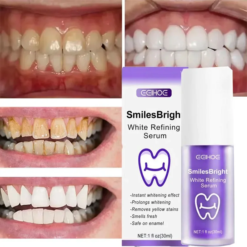 Pasta Gigi Pemutih Pembersih G - Teeth Whitening Korea ulasan dan harga
