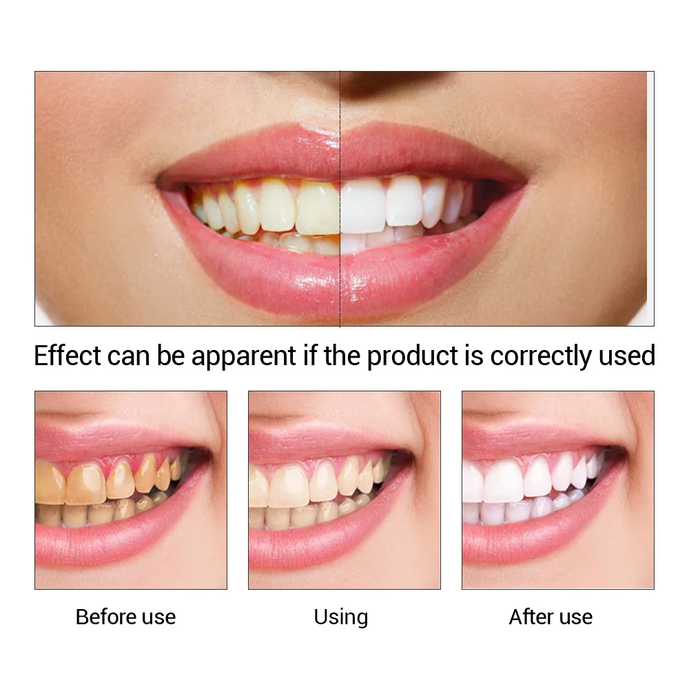 FTEENPLY Bubuk Esensi Pemutih  - Teeth Paint Whitening ulasan dan harga