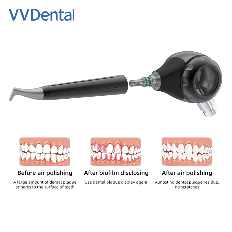 Alat Pembersih Gigi VVDental A - Colgate Whitening Teeth ulasan dan harga