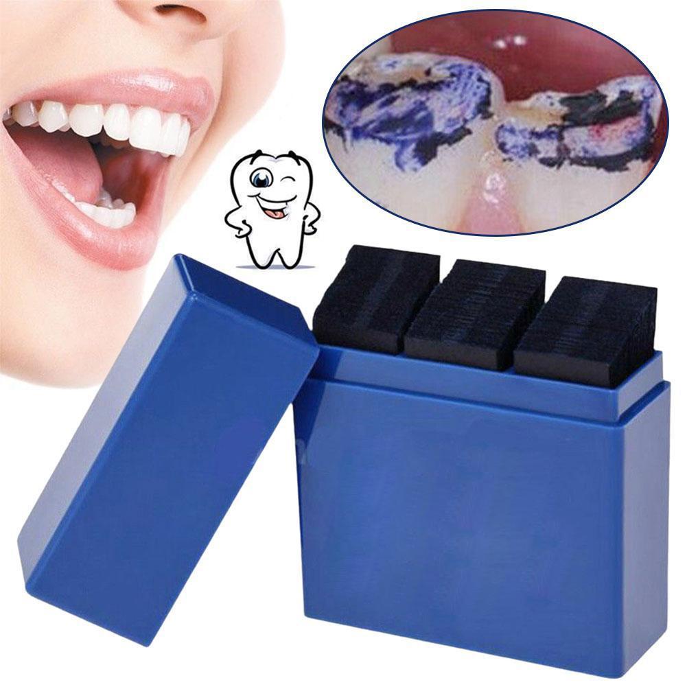 300 Lembar Kertas Artikulasi G - Teeth Whitening Professional ulasan dan harga