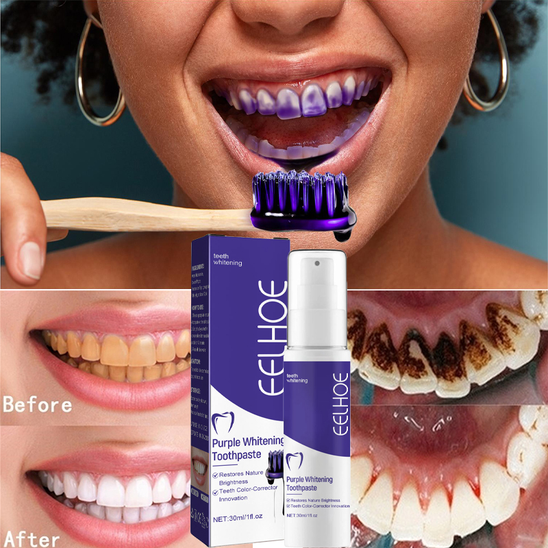 1 buah pasta gigi pemutih pemb - Teeth Whitening Korea ulasan dan harga