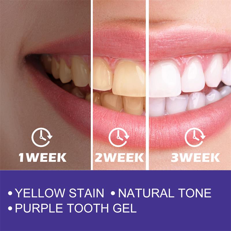 1 buah pasta gigi pemutih pemb - Teeth Whitening Korea ulasan dan harga