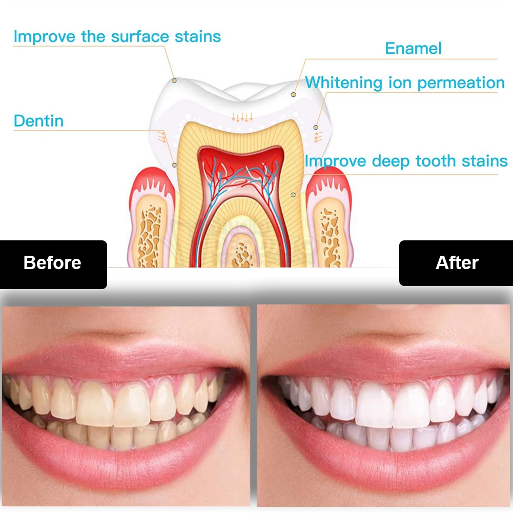 Kit pemutih gigi Mini 16 LED c - Teeth Whitening Gel Peroxide ulasan dan harga