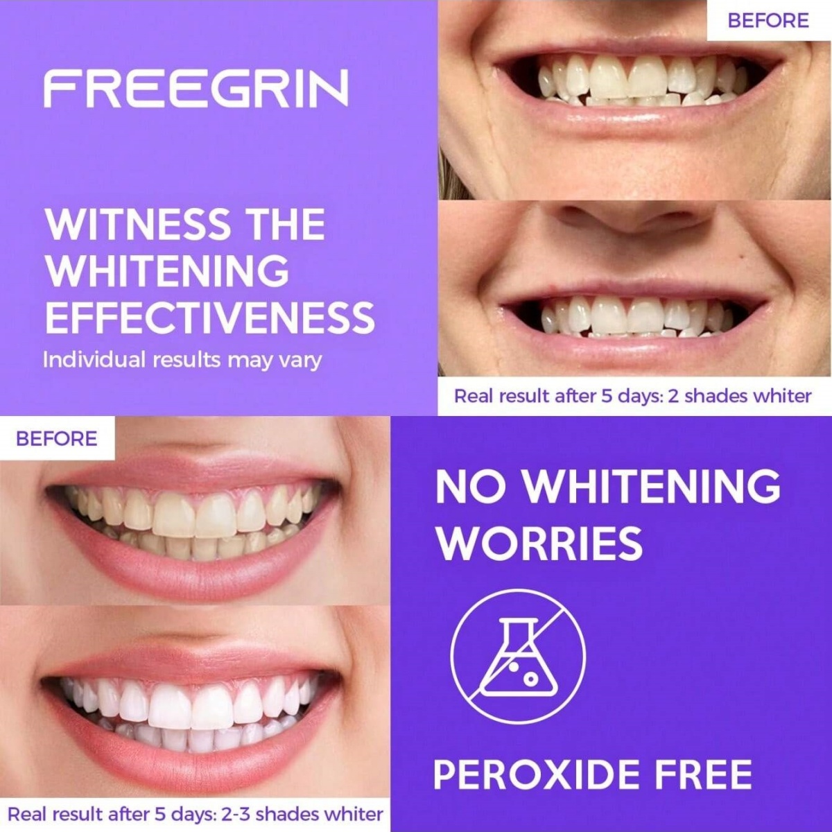 Stiker Gigi Pemutih Mewah 7/14 - Teeth Whitening Gel Peroxide ulasan dan harga