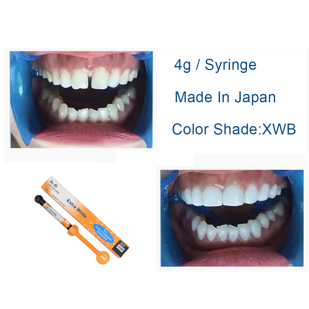 Resin Komposit Gigi Extra Whit - Teeth Whitening Professional ulasan dan harga