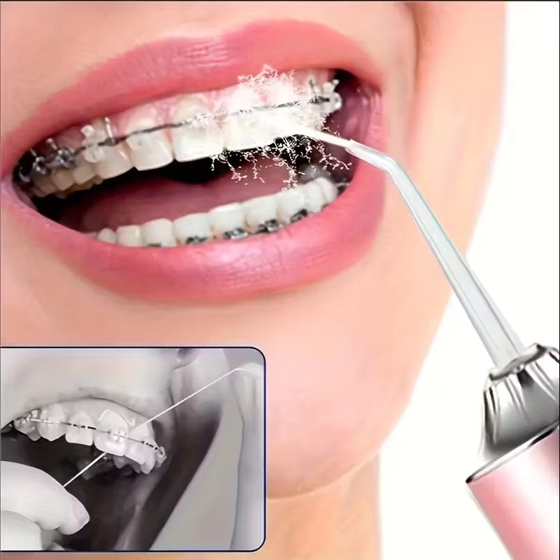 Irrigator Oral, Alat Pembersih - Whitening Mouthwash ulasan dan harga